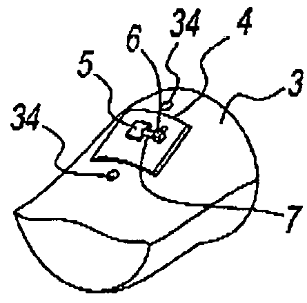 Synergetic Prosthesis