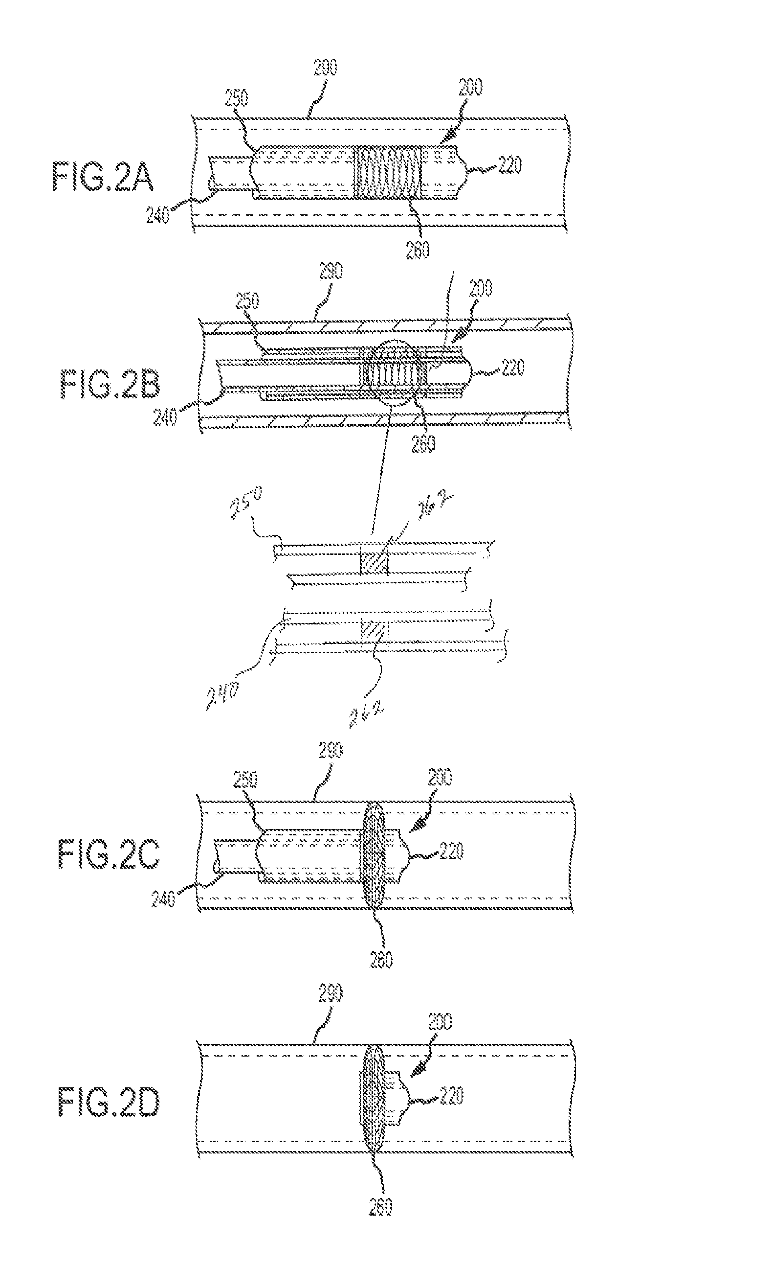 Devices and methods for treating venous diseases