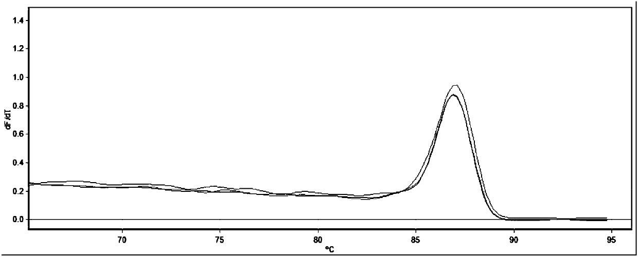 Real-time quantitative PCR detection primer set and method of differentially expressed acipenser dabryanus gonad gene