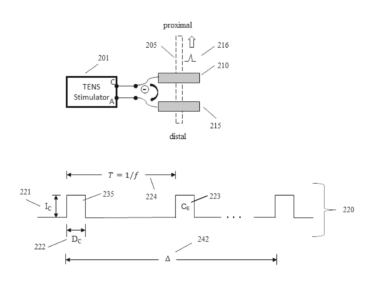 Transcutaneous electrical nerve stimulation using novel unbalanced biphasic waveform and novel electrode arrangement