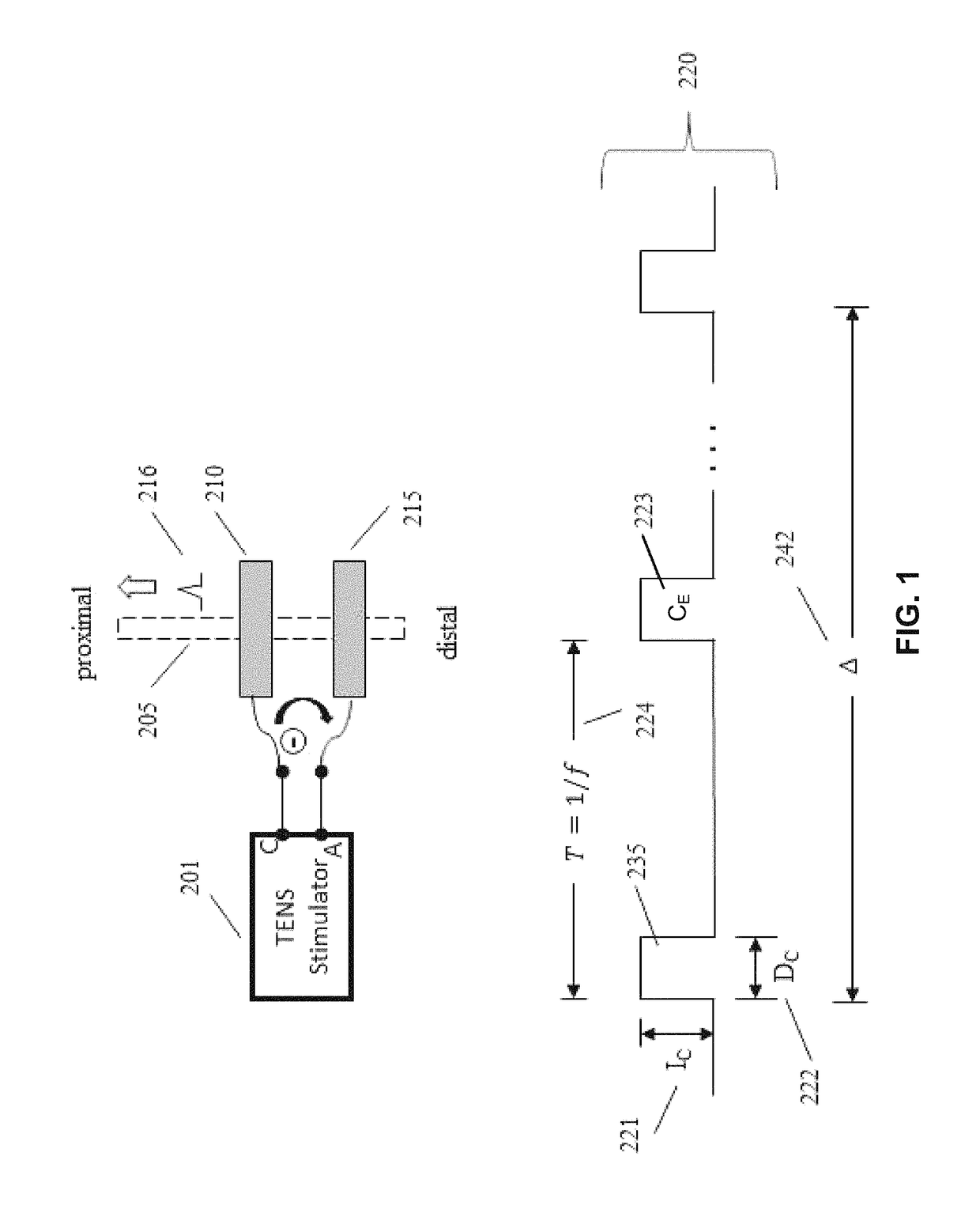 Transcutaneous electrical nerve stimulation using novel unbalanced biphasic waveform and novel electrode arrangement