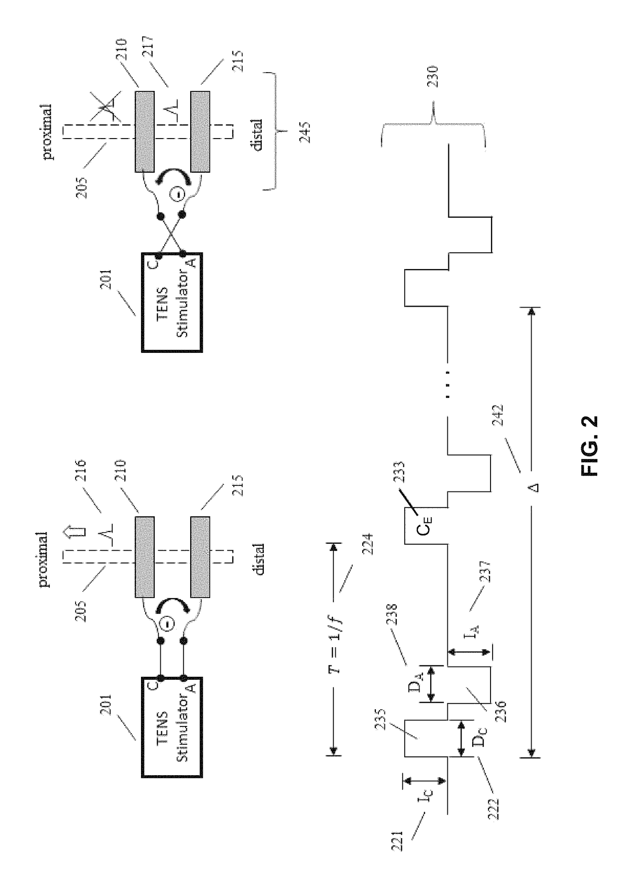 Transcutaneous electrical nerve stimulation using novel unbalanced biphasic waveform and novel electrode arrangement