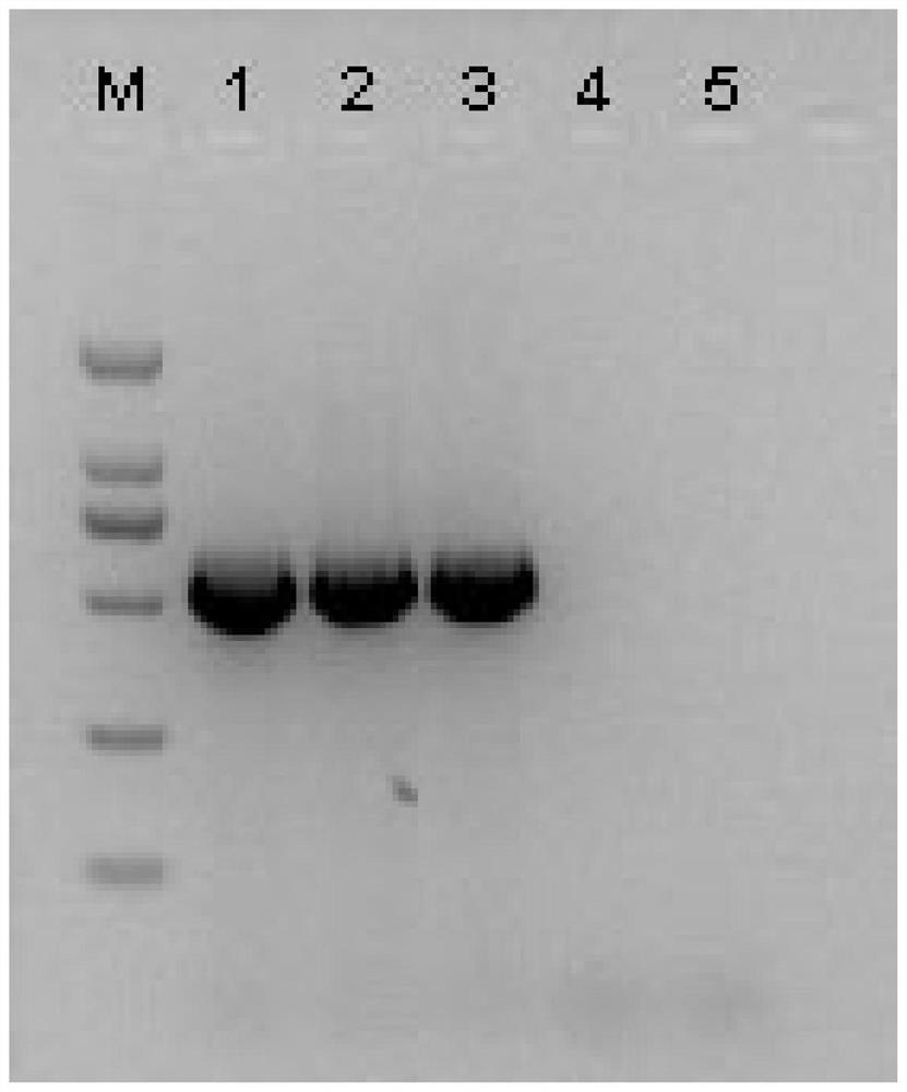 Primer pair for amplifying watermelon latent virus and application thereof