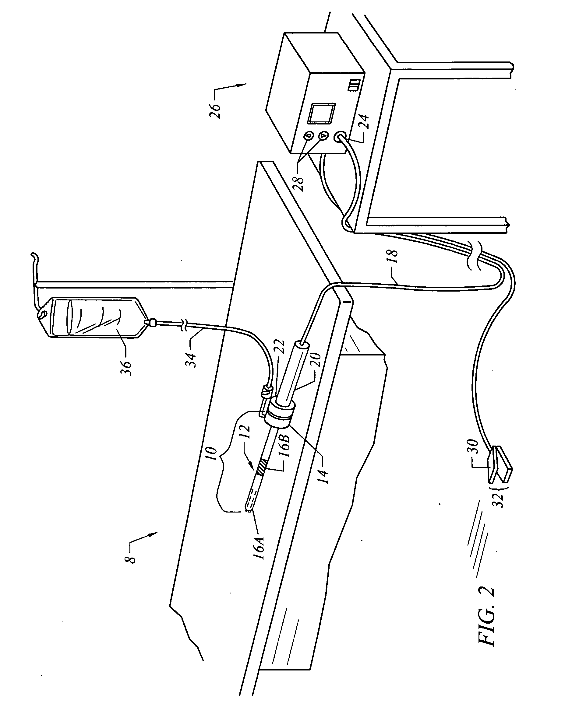 Electrosurgical method and system for treating foot ulcer