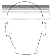 Three-dimensional graphical lamina positioning method in magnetic resonance imaging and magnetic resonance imaging system