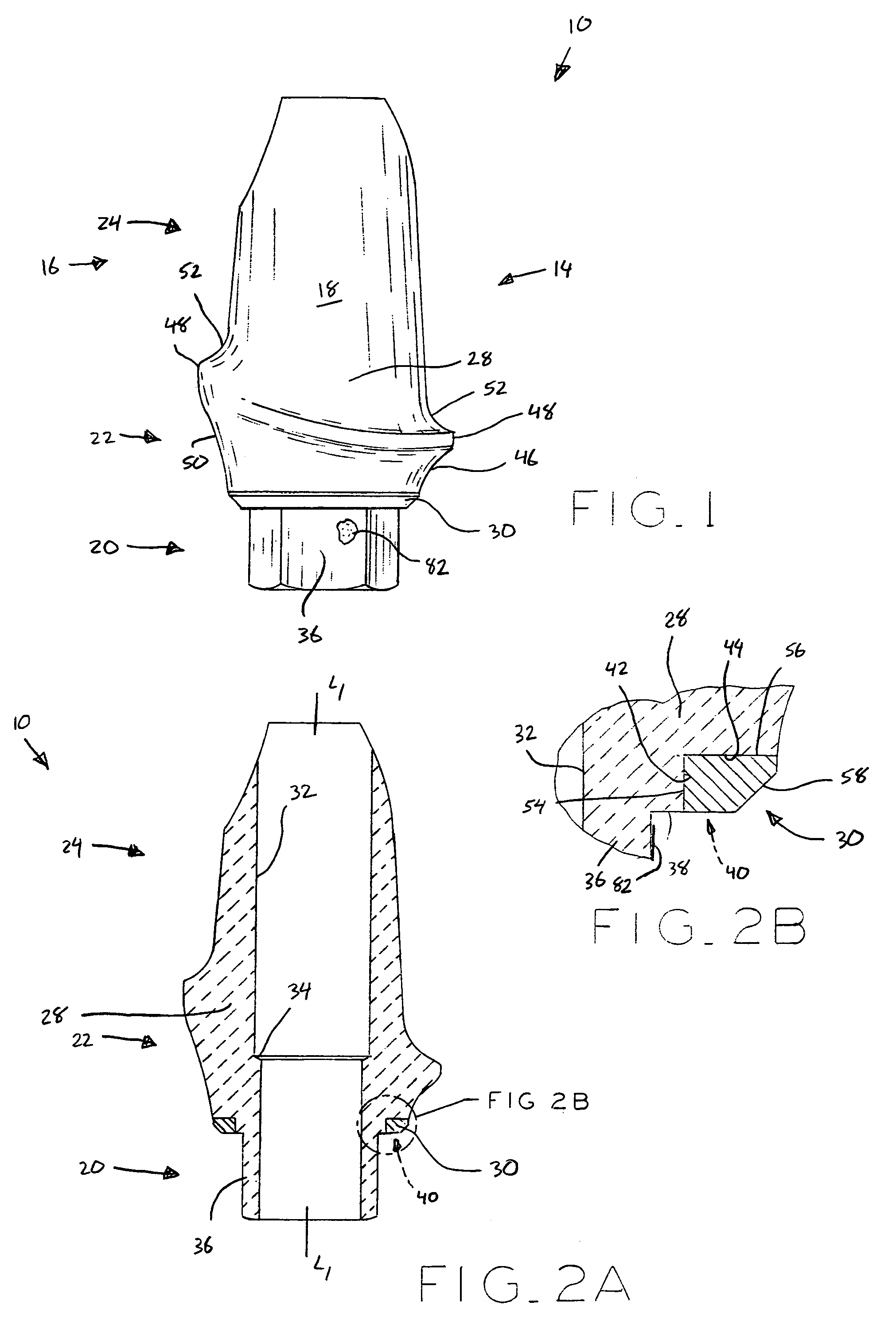 Ceramic/metallic dental abutment