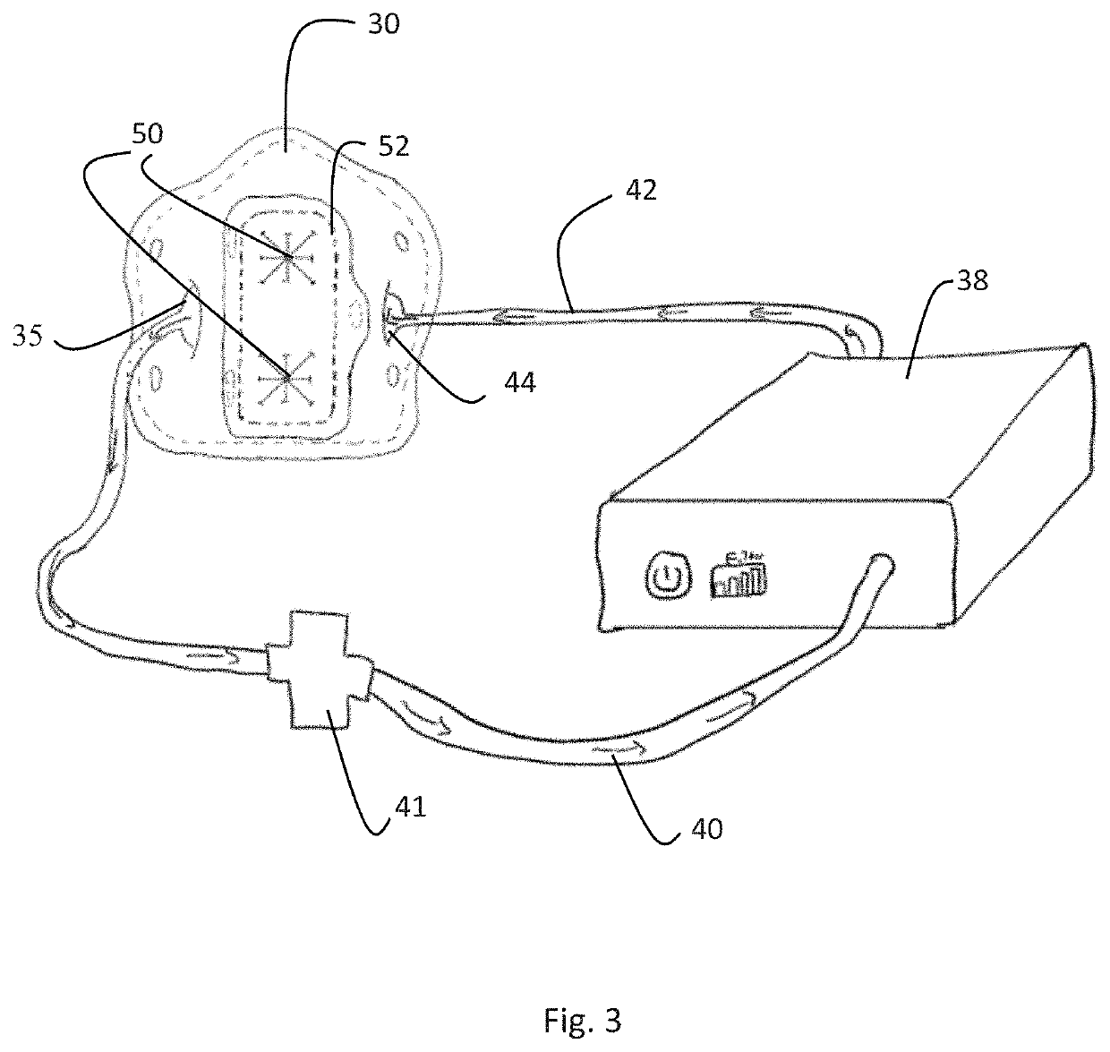 Devices, systems, and methods for protecting healthcare workers from airborne pathogens