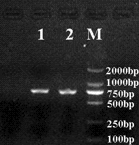 Preparation and application methods of genetically engineered bacterium expressing thymosin beta4