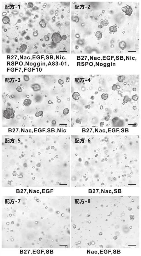 Culture medium and culture method for thyroid cancer organoid