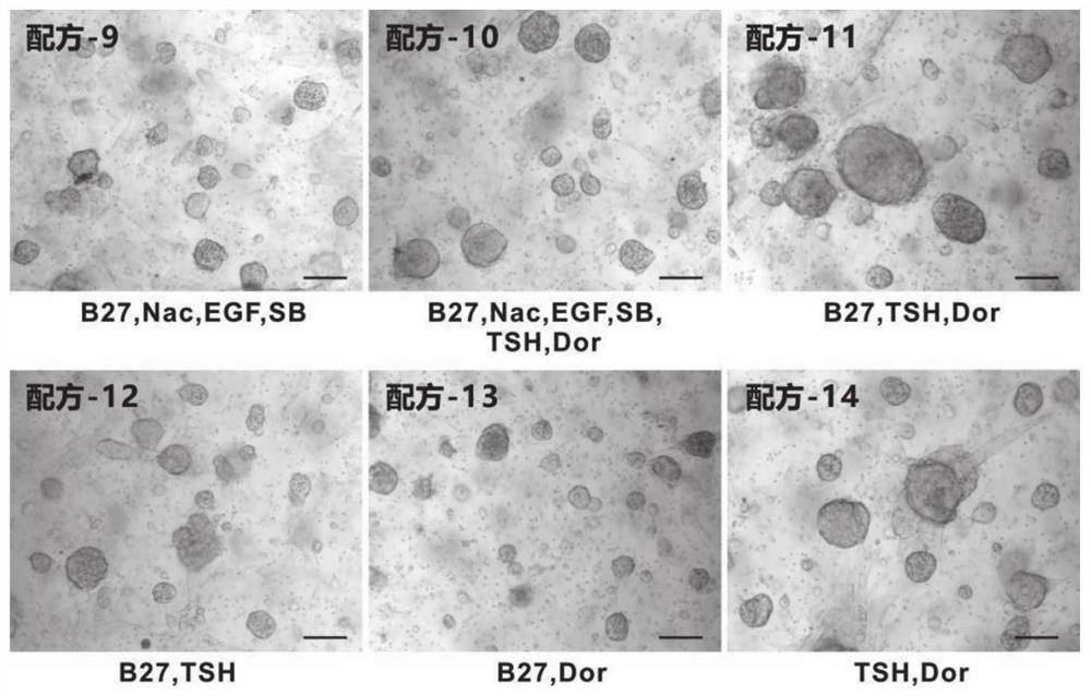 Culture medium and culture method for thyroid cancer organoid