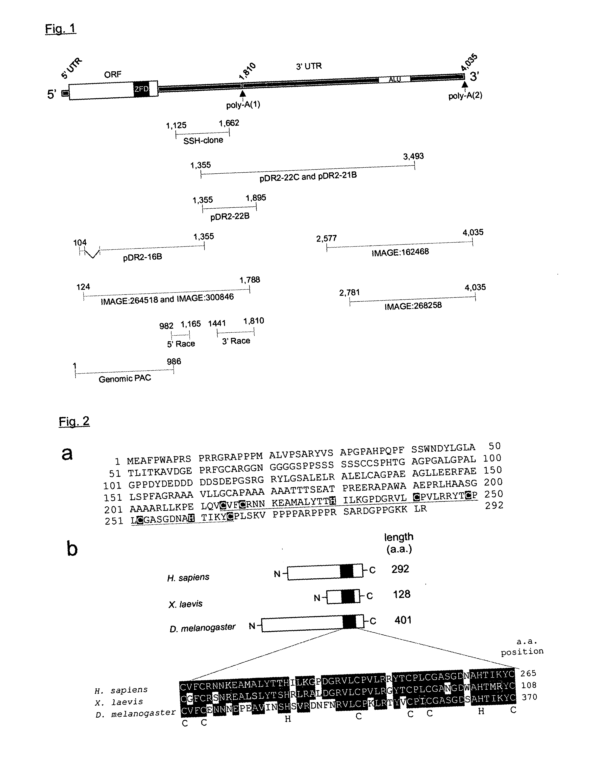 Method to control tumor progression and invasiveness