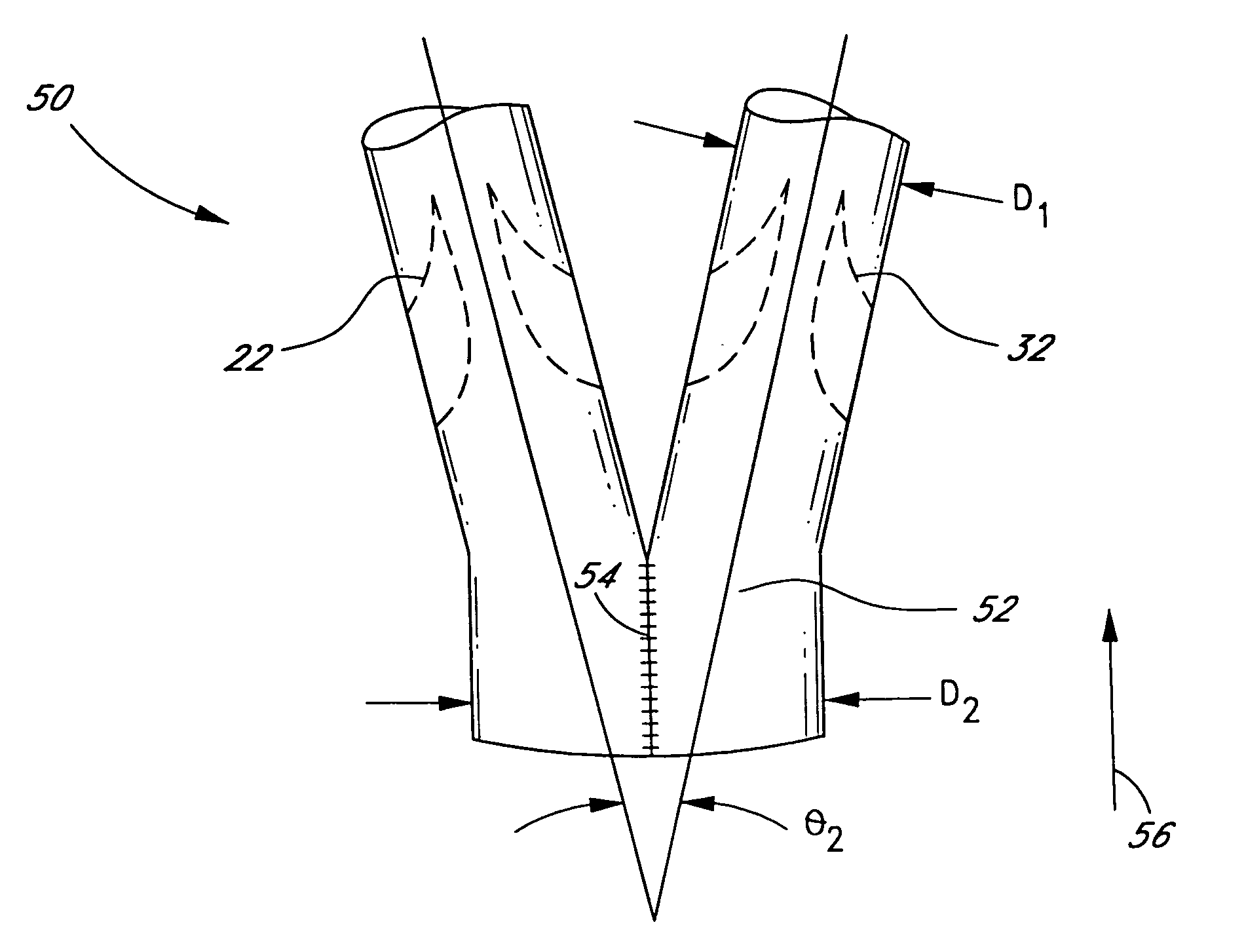 Bifurcated biological pulmonary valved conduit