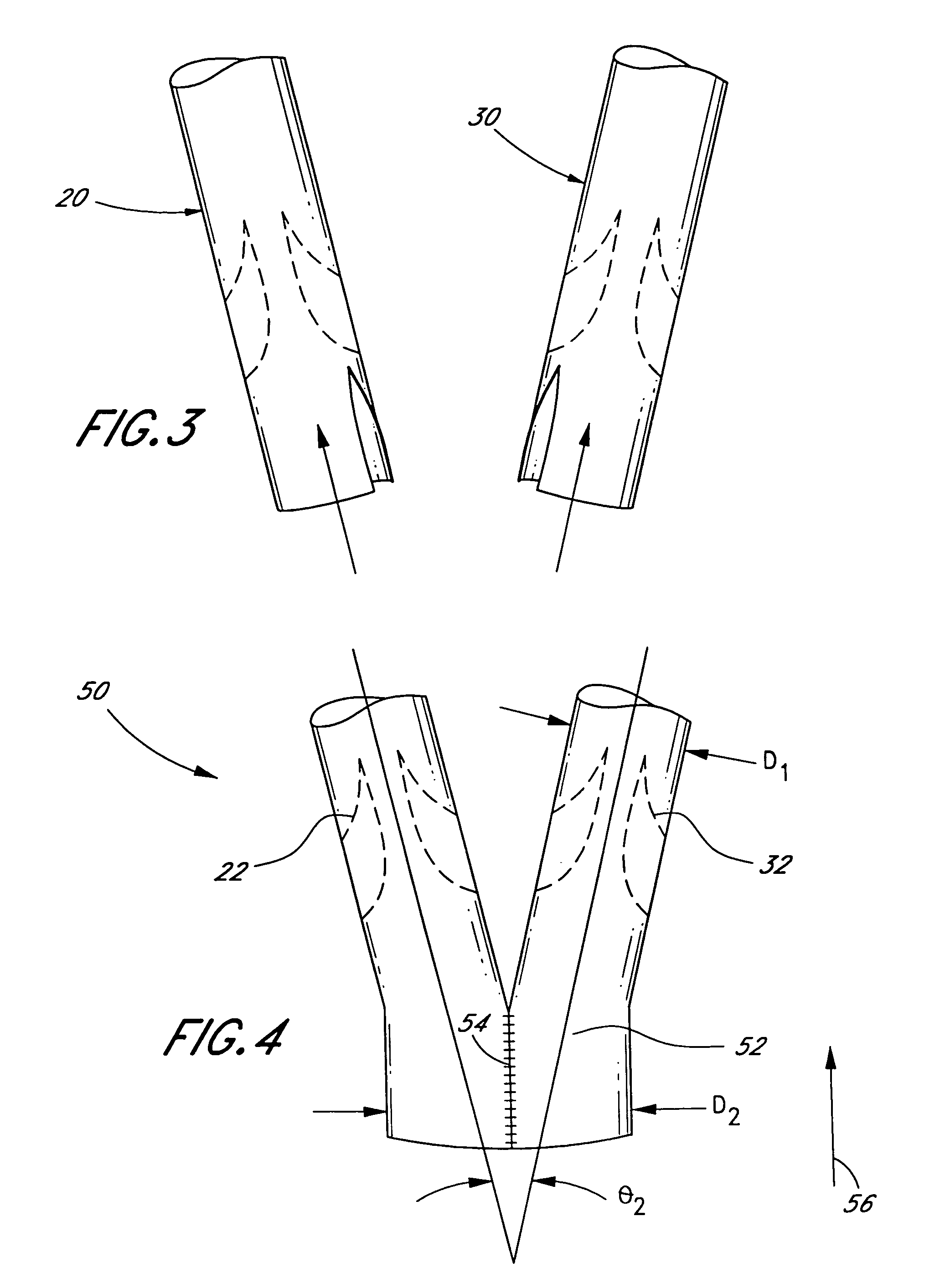 Bifurcated biological pulmonary valved conduit