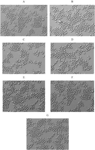 A kind of fetal bovine serum substitute and its preparation method and application