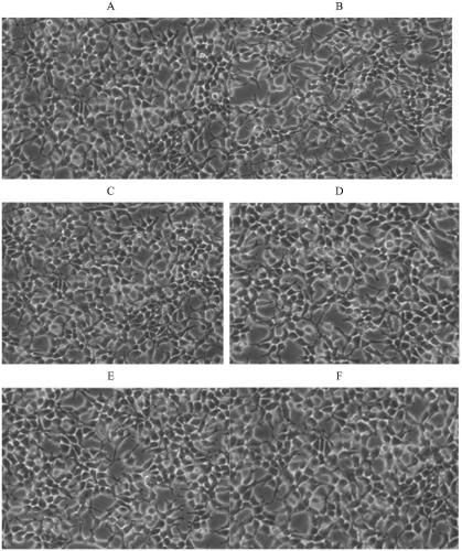 A kind of fetal bovine serum substitute and its preparation method and application