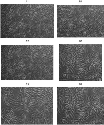 A kind of fetal bovine serum substitute and its preparation method and application