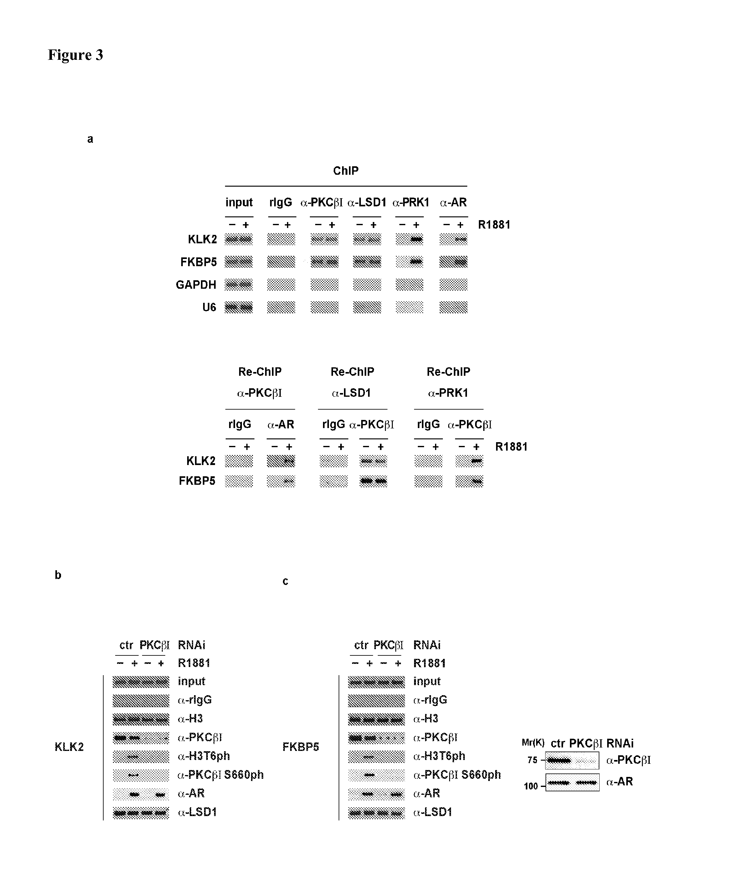 Methods and Compounds for the Diagnosis and Treatment for Cancer