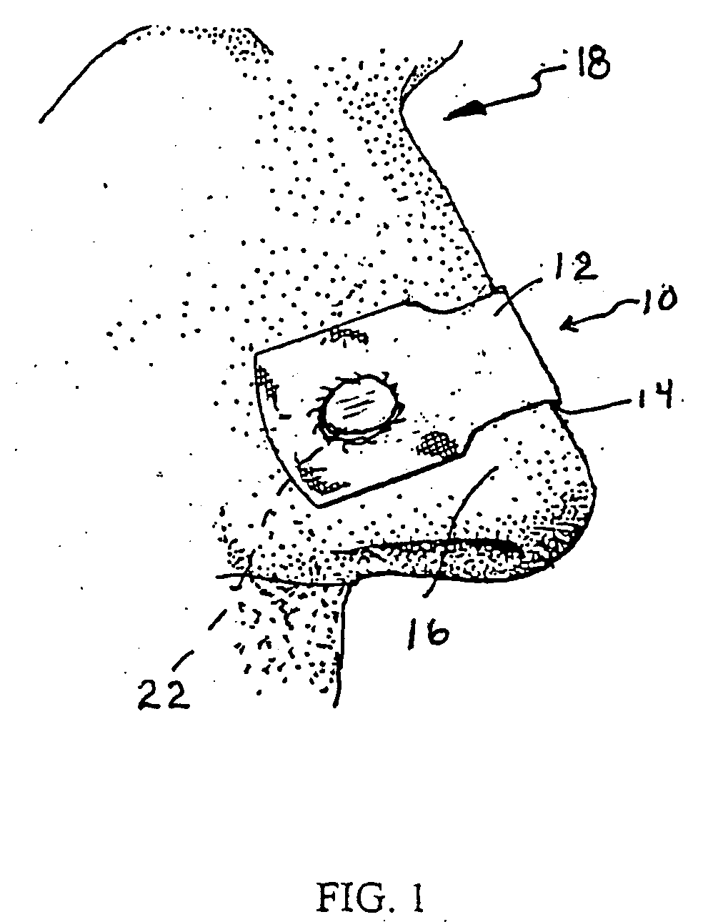 Nasal devices including dilation and user communication and methods of using same