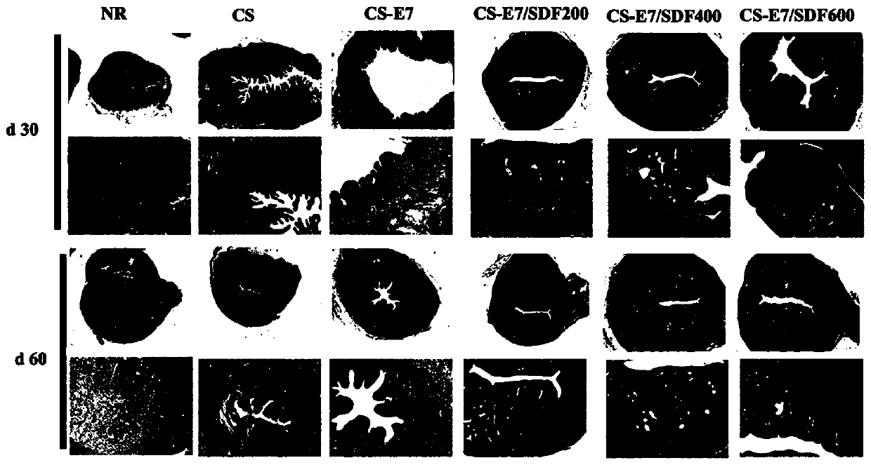 Bioactive scaffold for repairing endometrium and improving fertility