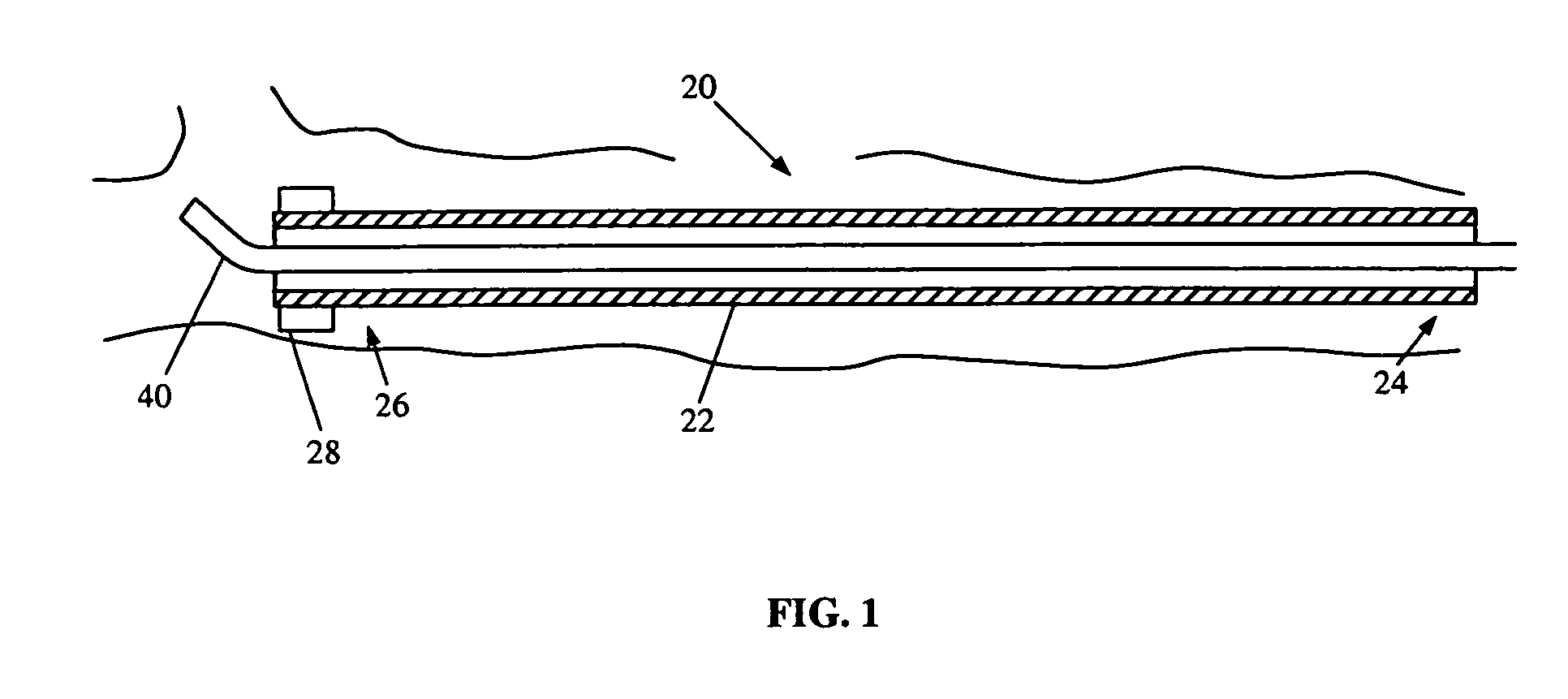 Magnetic navigation maneuvering sheath