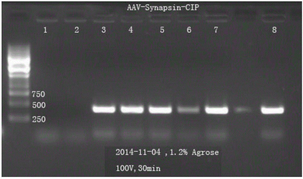 AAV9-CIP virus of expressed neurodegenerative disease protection peptide and preparation method of AAV9-CIP virus