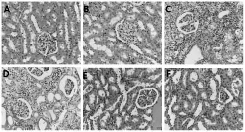 A traditional Chinese medicine composition for assisting in improving renal function in patients with chronic kidney disease