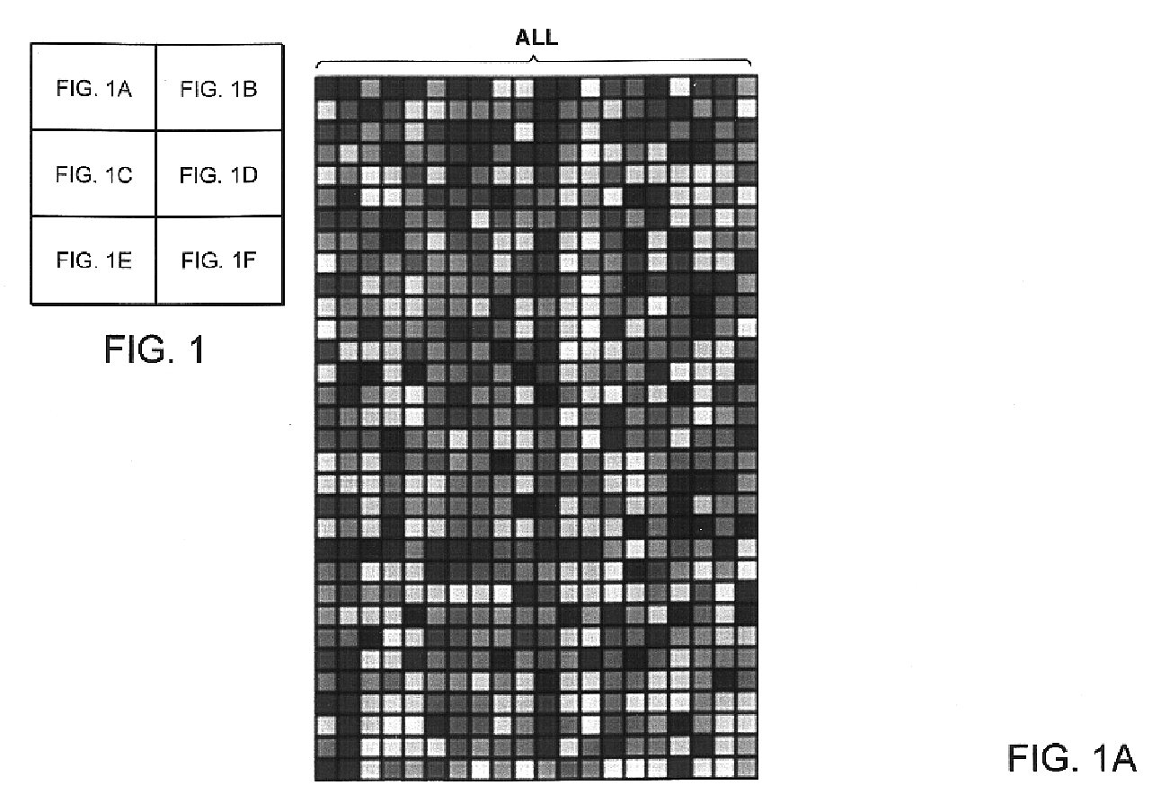 MLL translocations specify a distinct gene expression profile, distinguishing a unique leukemia