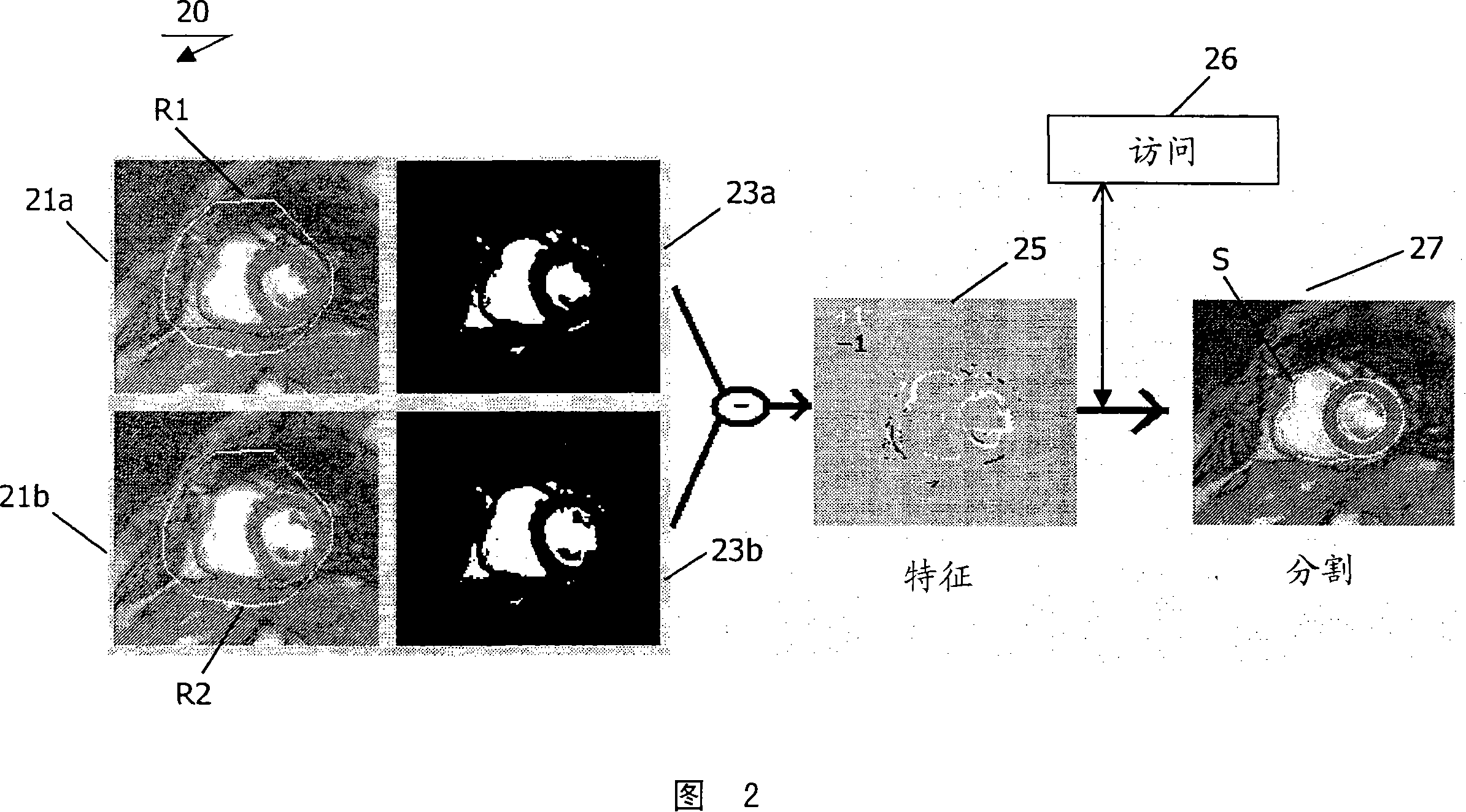 A method, a system and a computer program for segmenting a structure in a dataset