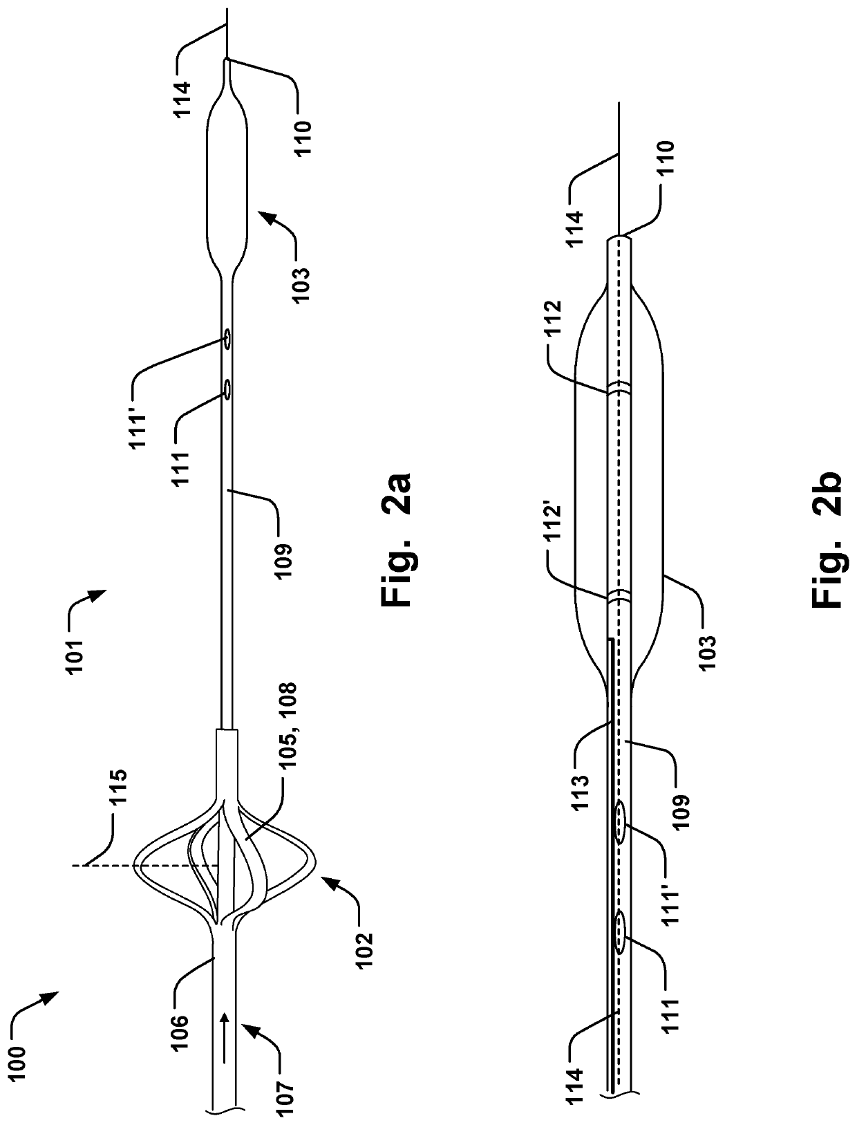 Medical System for Annuloplasty