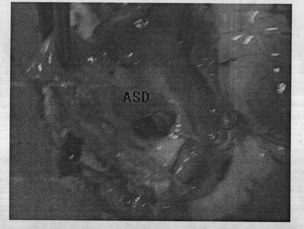 Method for constructing congenital heart disease with diminutive pulmonary blood animal model