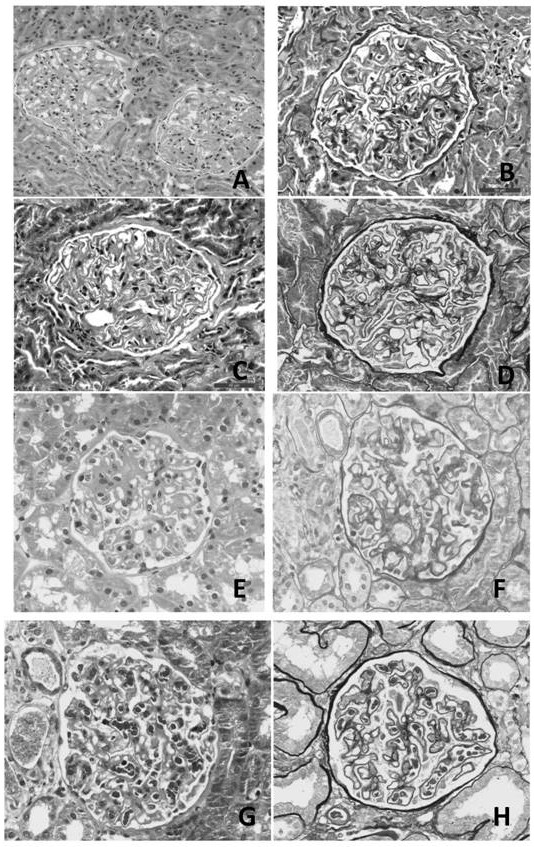 Method for reproducing paraffin sections from kidney biopsy immunofluorescence frozen residual tissues