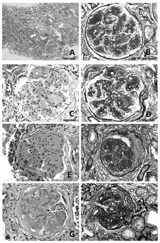 Method for reproducing paraffin sections from kidney biopsy immunofluorescence frozen residual tissues