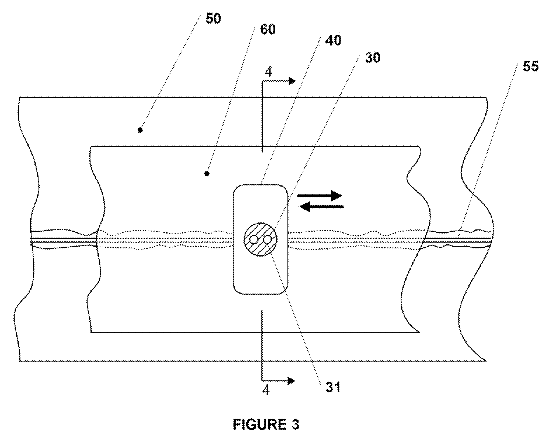 Ultrasound assisted tissue welding device