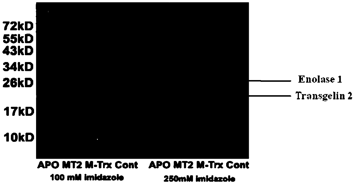 Application of actin-binding protein 2 in screening smooth muscle dysfunction disease therapeutic drugs