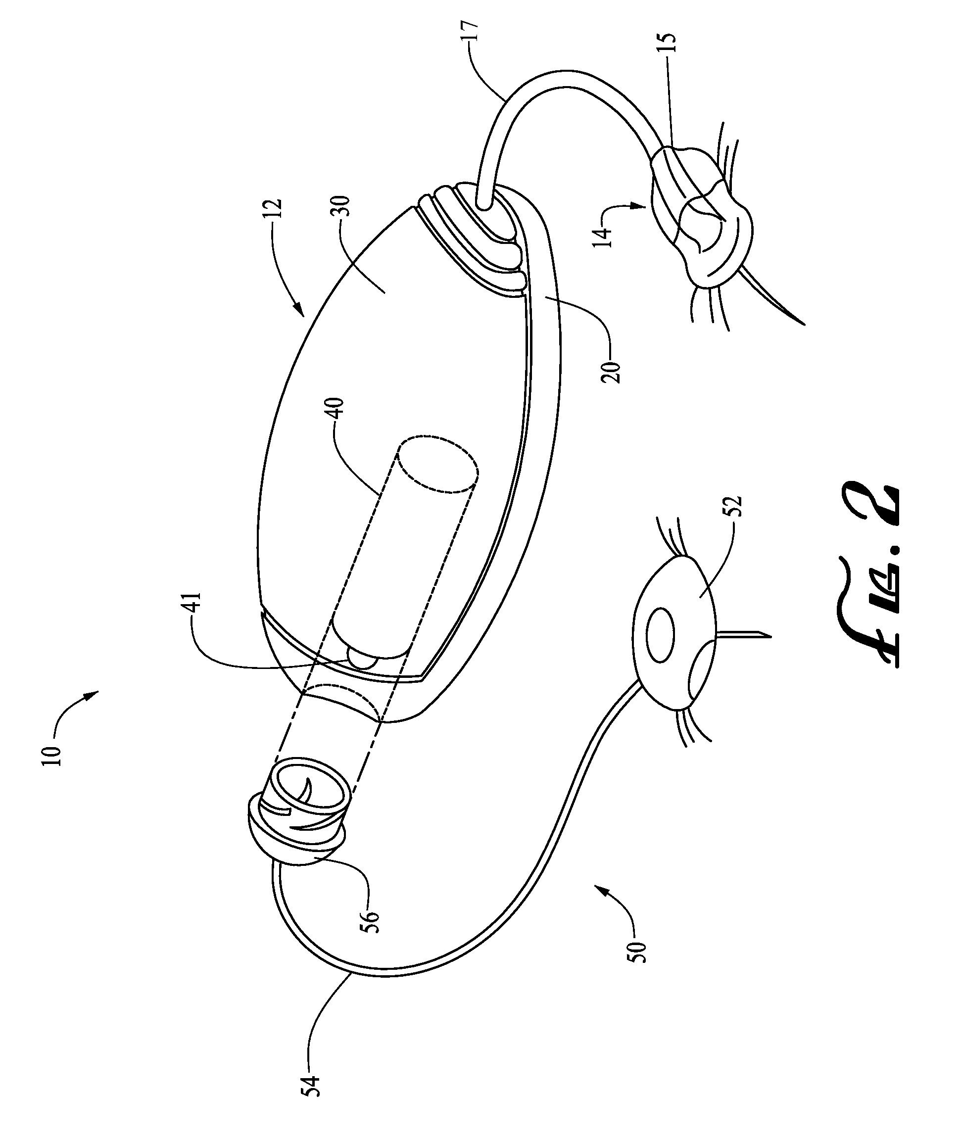 Motor assembly sensor capture systems and methods