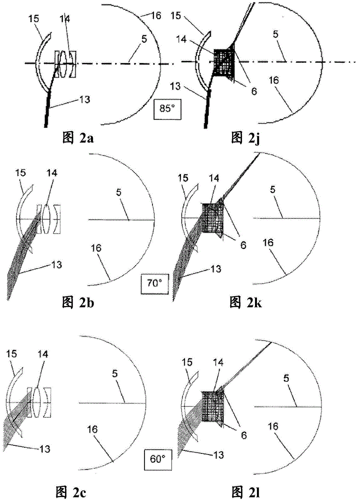 Wide Angle Optics for Ophthalmic Implants