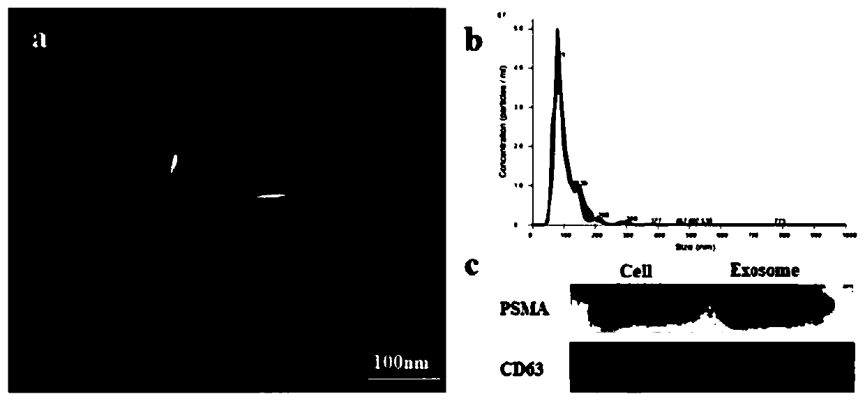 Kit used for tumor exosome nanometer fluorescence detection and application of kit