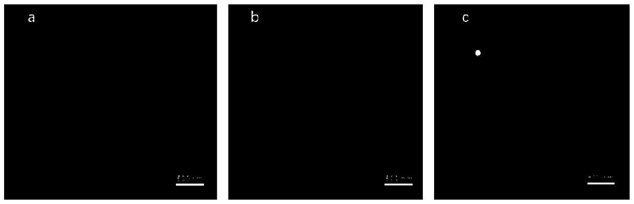 Kit used for tumor exosome nanometer fluorescence detection and application of kit