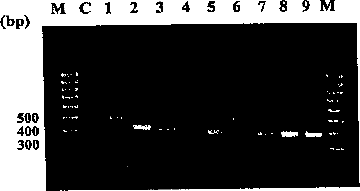 Oligonucleotide for detection and identification of mycobacteria