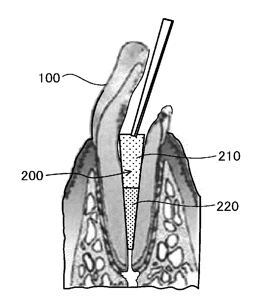 Unextracted tooth root canal filler and dental tissue regeneration method for unextracted tooth