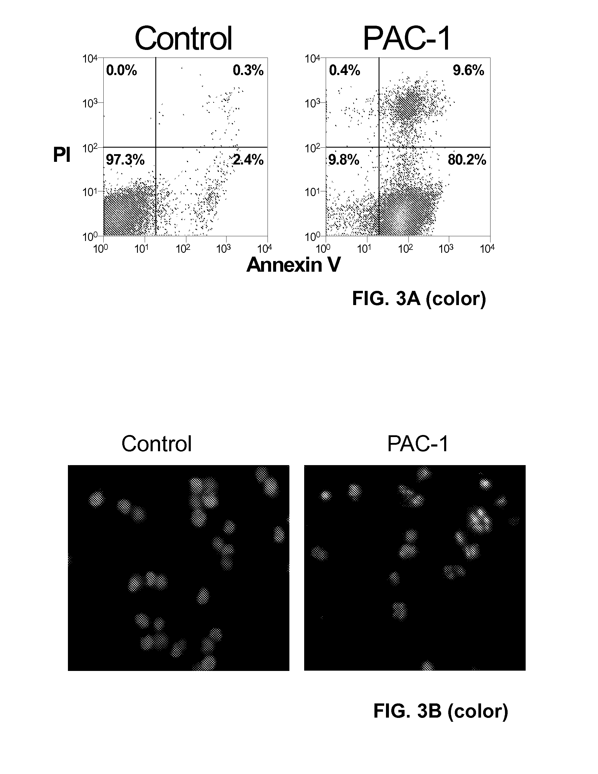 Compositions and methods including cell death inducers and procaspase activation