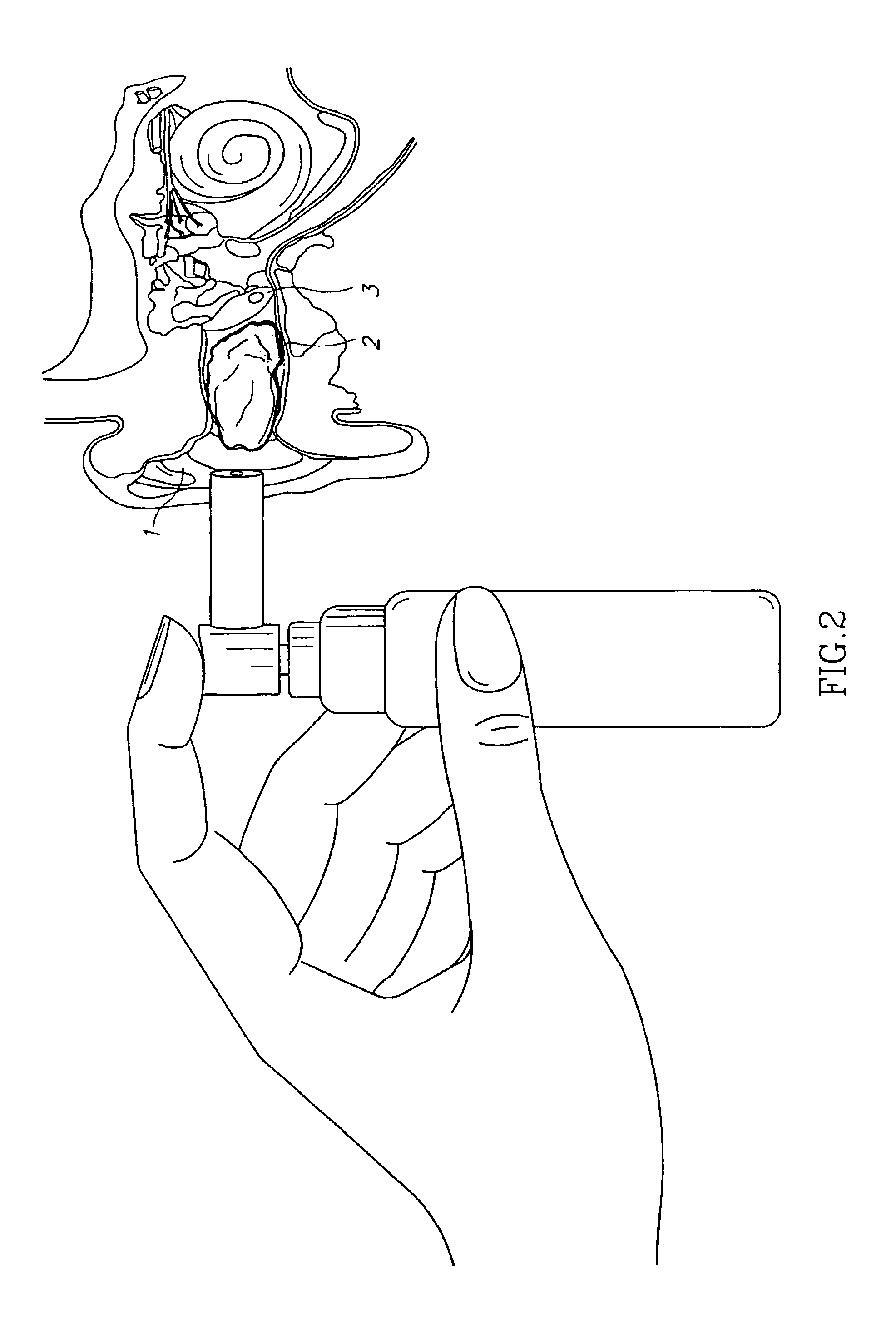 Compositions for treatment of ear disorders and methods of use thereof