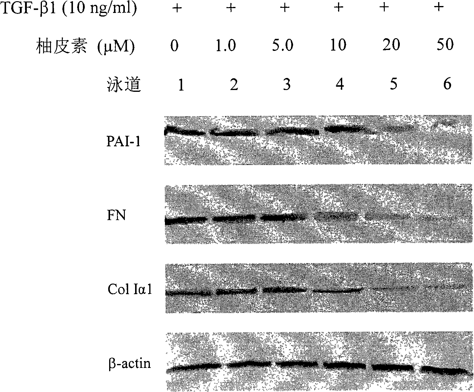 Applications of naringenin and naringin as signal pathway inhibitor of transforming growth factor-beta 1