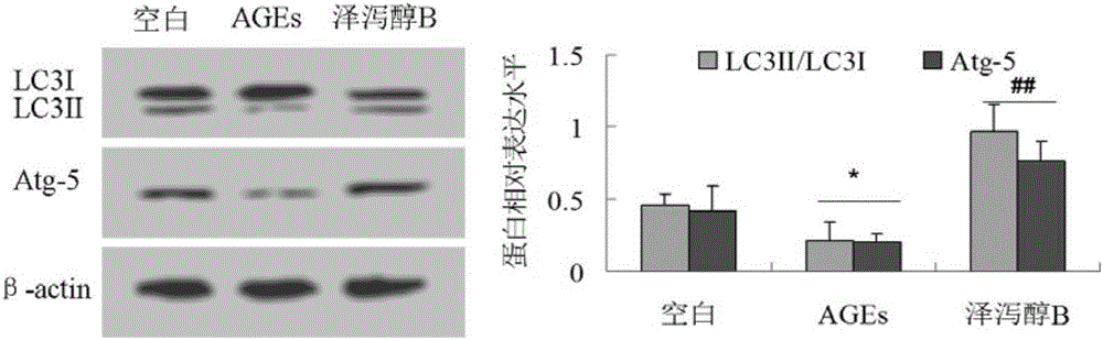 Autophagy revulsive for diabetic vascular complication treatment and application in medicine