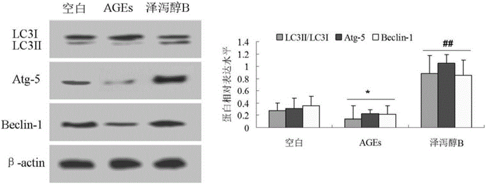 Autophagy revulsive for diabetic vascular complication treatment and application in medicine