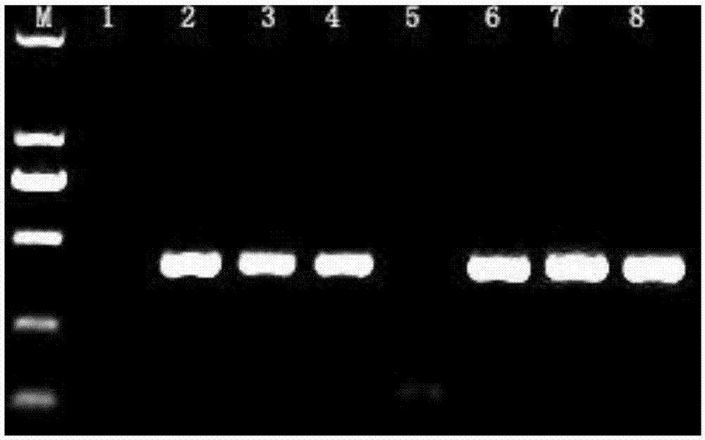 Universal primer for identifying pathogenic species of potato scabs and detection method