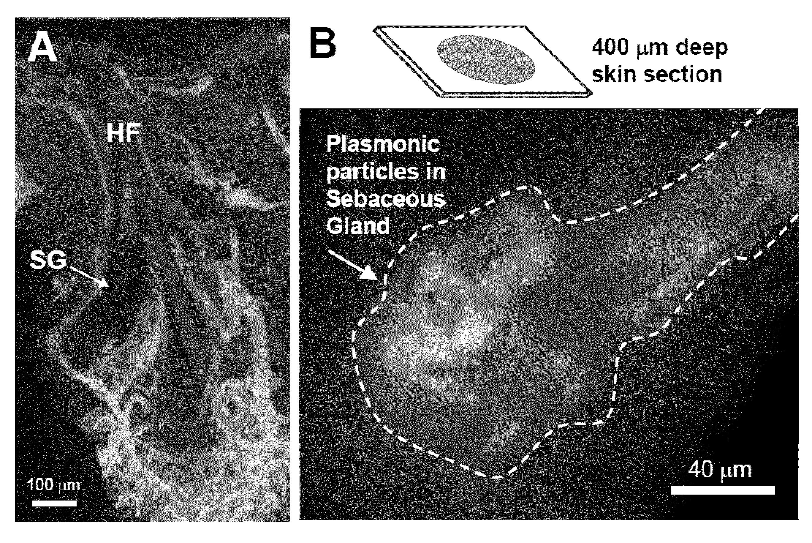 Ultrasound delivery of nanoparticles