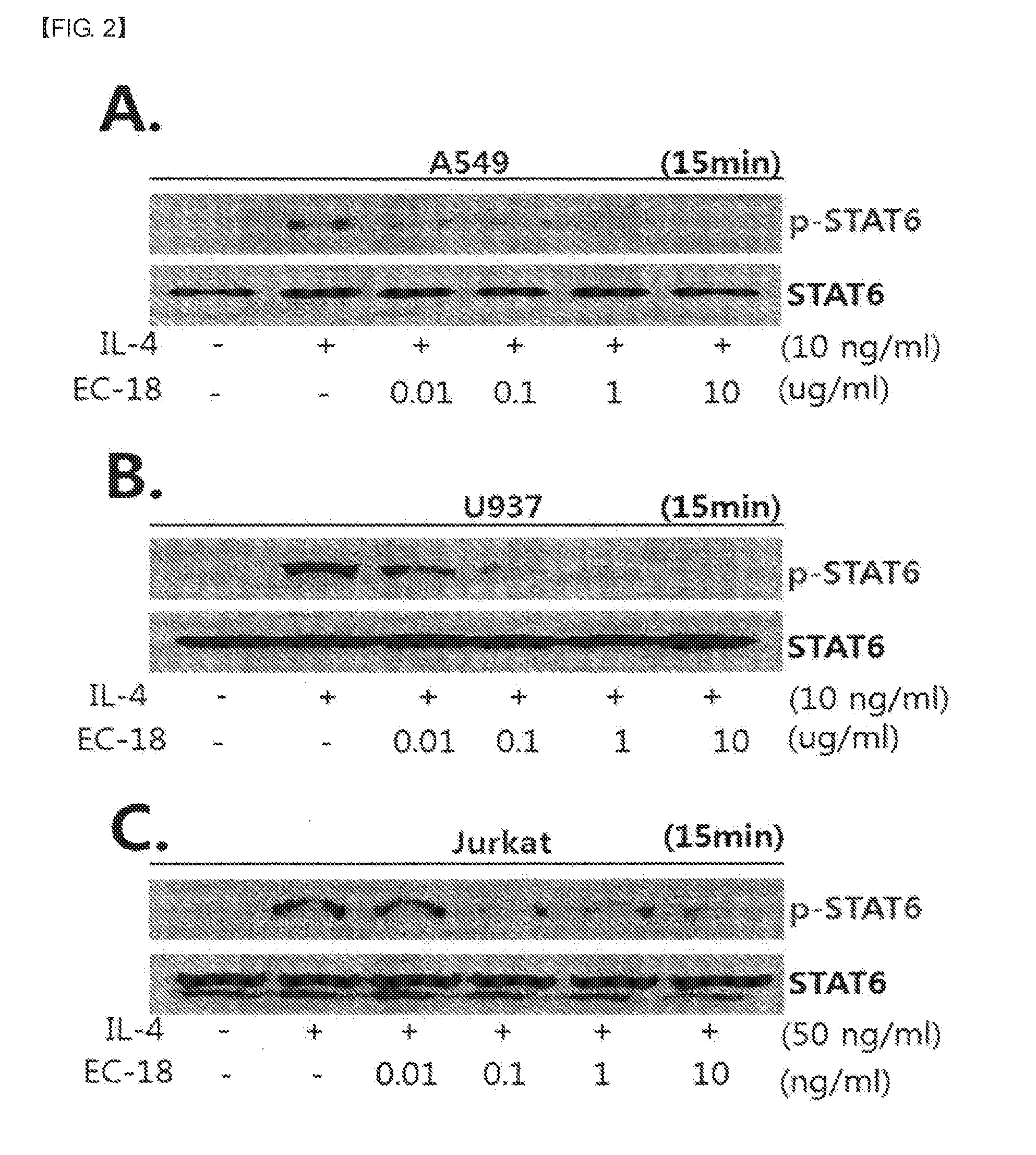 Composition containing monoacetyldiacylglycerol compound as active ingredient for inhibiting blood cancer or metastasis