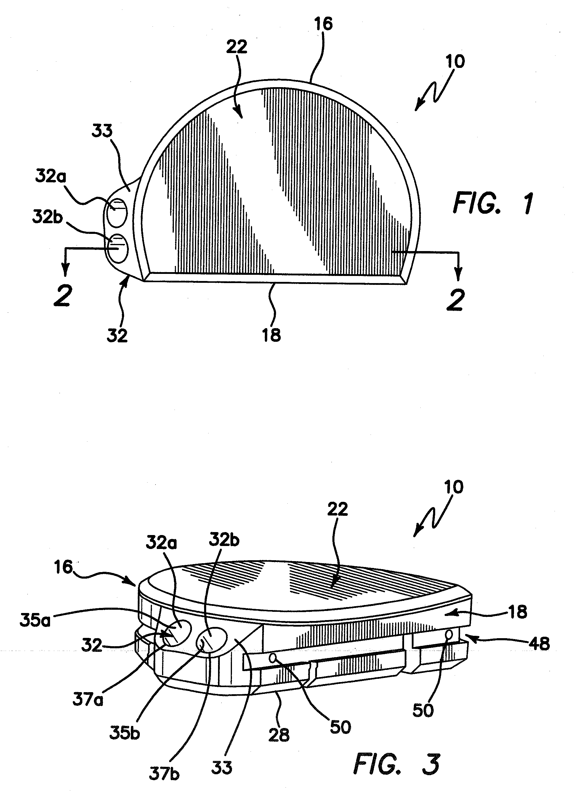 Tibial Prosthesis