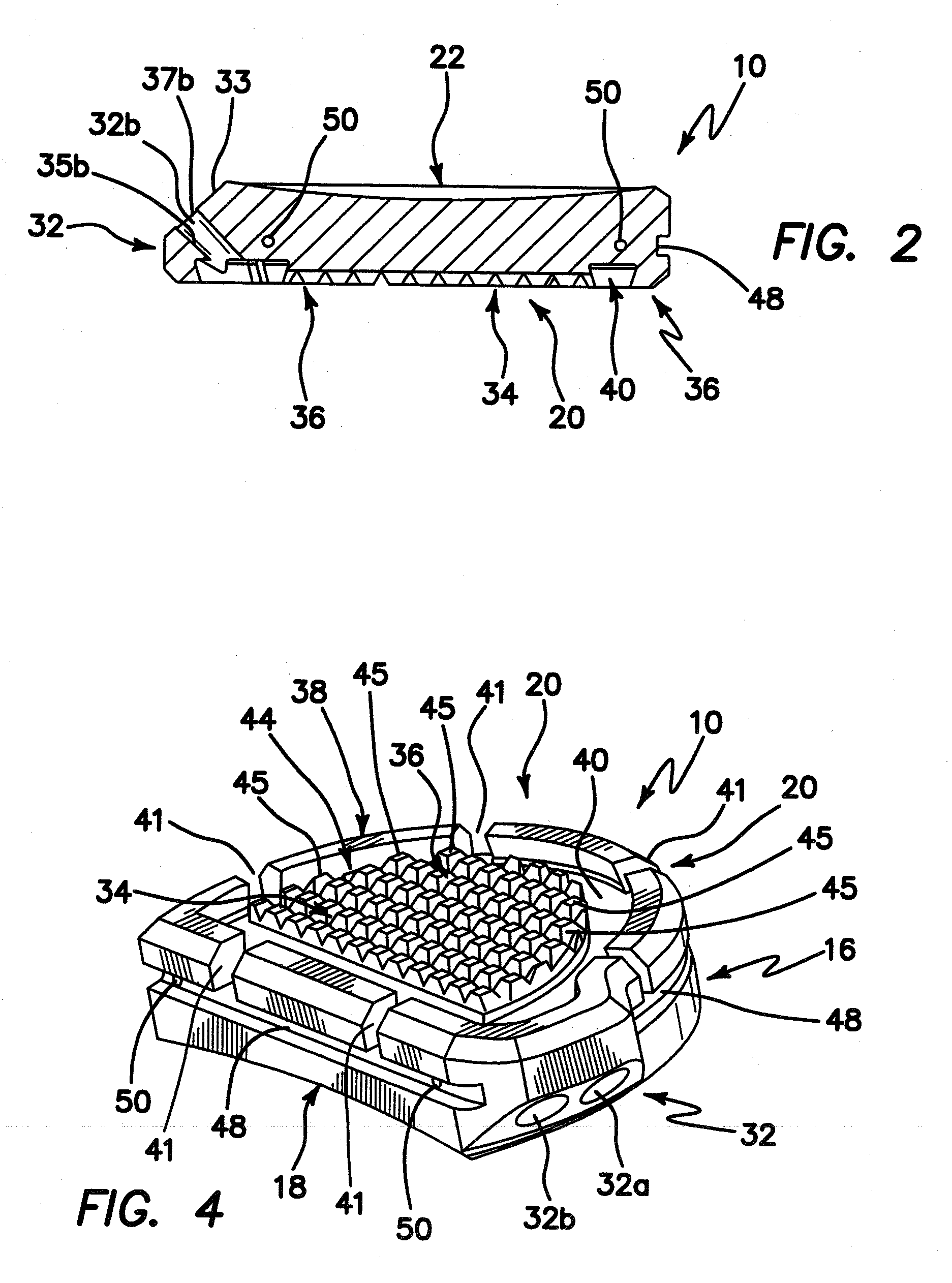 Tibial Prosthesis